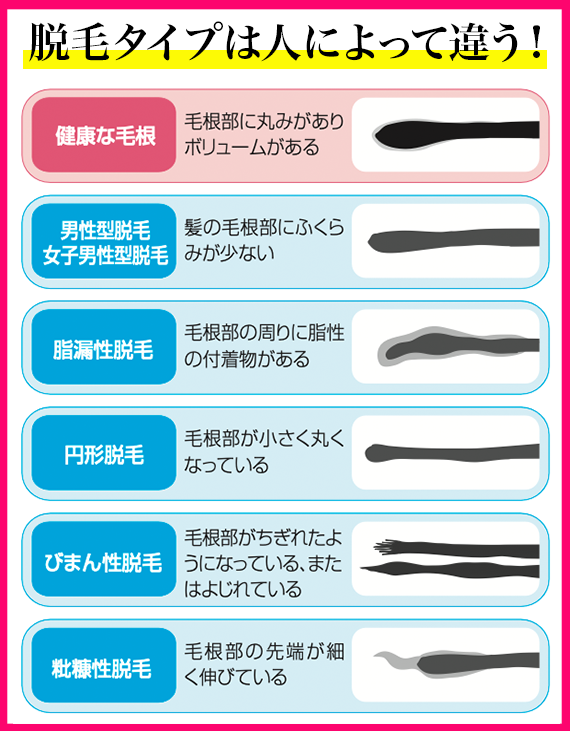 自信が持てない毎日にサヨナラ、髪と向き合う新しい日々