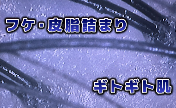 髪の毛のプロが、あなたの未来をサポート